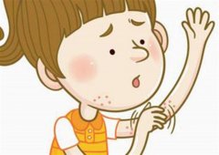 皮肤过敏的预防怎样