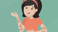 带状疱疹的危害怎么样